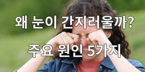 왜 눈이 간지러울까? 눈 간지러움의 주요 원인 5가지