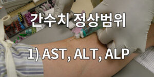 간수치 정상범위 1) AST, ALT, ALP 팩트 확인!