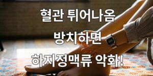 혈관 튀어나옴, 방치하면 '하지정맥류' 악화!