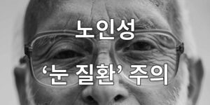 노인성 눈 질환 주의