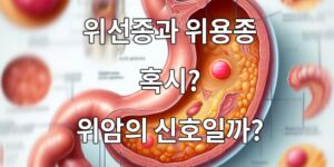 위선종과 위용종, 혹시? 위암의 신호일까?