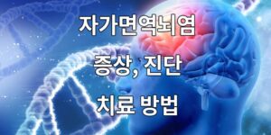 자가면역뇌염의 증상, 진단, 치료방법.