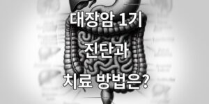 대장암 1기 진단과 치료 방법은?