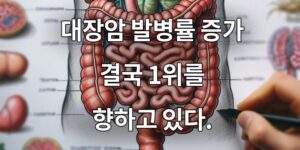 대장암 발병률 증가 결국 1위를 향하고 있다.