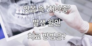 잇몸 속 치아종 발생 원인과 치료 방법은?