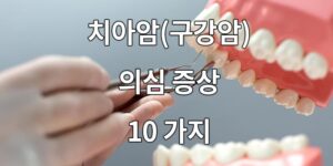 치아암(구강암)의심 증상 10가지 10 Suspicious Symptoms of Teeth and Lives